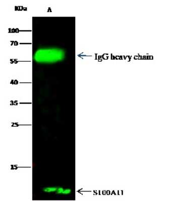 Immunoprecipitation: S100A11 Antibody [NBP2-99718]