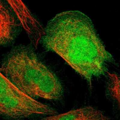 Immunocytochemistry/ Immunofluorescence: S100A13 Antibody [NBP1-86039]