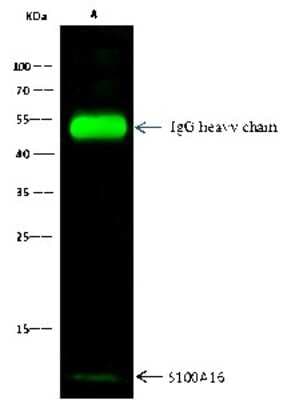 Immunoprecipitation: S100A16 Antibody [NBP2-99717]