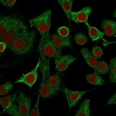Immunocytochemistry/ Immunofluorescence: S100A2 Antibody (CPTC-S100A2-2) - Azide and BSA Free [NBP2-79899]