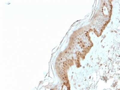 Immunohistochemistry-Paraffin: S100A2 Antibody (CPTC-S100A2-2) [NBP2-79764]