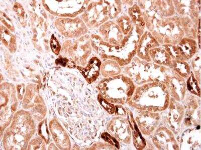 Immunohistochemistry-Paraffin: S100A2 Antibody [NBP2-20247]