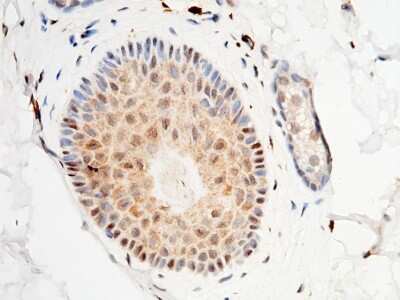 Immunohistochemistry-Paraffin: S100A3 Antibody [NBP2-99716]