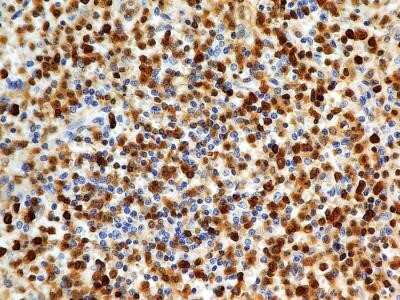 Immunohistochemistry: S100A4 Antibody (1C4) - Azide and BSA Free [NBP2-80936]