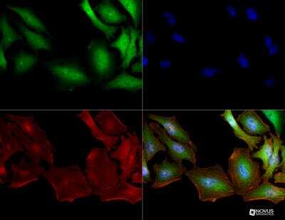 Immunocytochemistry/ Immunofluorescence: S100A4 Antibody (1C4) - BSA Free [NBP2-36431]