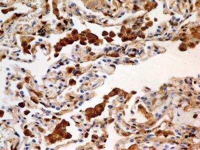 Immunohistochemistry-Paraffin: S100A4 Antibody (1C4) - BSA Free [NBP2-36431]