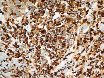 Immunohistochemistry-Paraffin: S100A4 Antibody (1C4) - BSA Free [NBP2-36431]