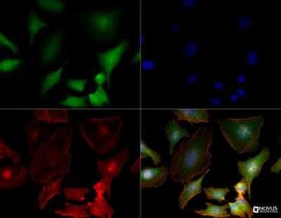 Immunocytochemistry/ Immunofluorescence: S100A4 Antibody (1F11) - Azide and BSA Free [NBP2-80935]