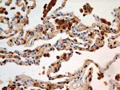 Immunohistochemistry: S100A4 Antibody (1F11) - Azide and BSA Free [NBP2-80935]