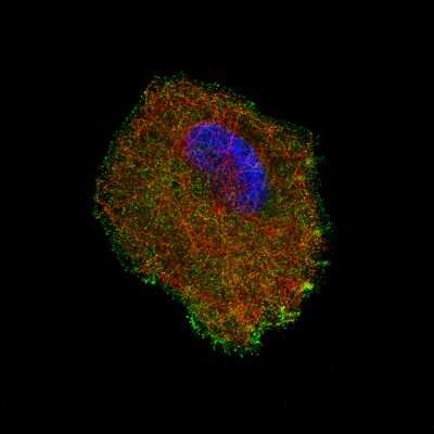 Immunocytochemistry/ Immunofluorescence: S100A4 Antibody (CL0237) [NBP2-52890]