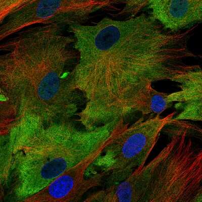 Immunocytochemistry/ Immunofluorescence: S100A4 Antibody (CL0239) [NBP2-52891]