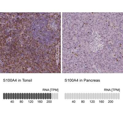 Immunohistochemistry-Paraffin: S100A4 Antibody (CL0239) [NBP2-52891]