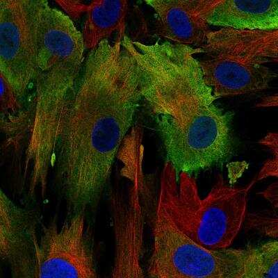 Immunocytochemistry/ Immunofluorescence: S100A4 Antibody (CL0240) [NBP2-52892]