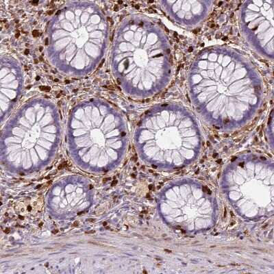Immunohistochemistry-Paraffin: S100A4 Antibody (CL0240) [NBP2-52892]