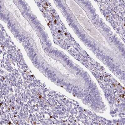 Immunohistochemistry-Paraffin: S100A4 Antibody (CL0240) [NBP2-52892]
