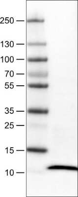 Western Blot: S100A4 Antibody (CL0240) [NBP2-52892]