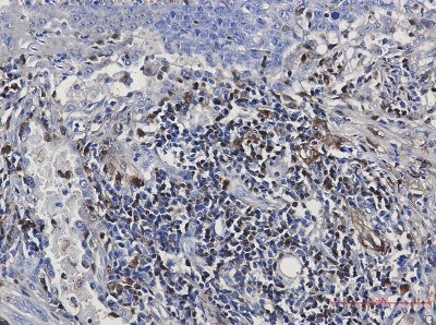 Immunohistochemistry-Paraffin: S100A4 Antibody (S01-7H1) [NBP3-19607]