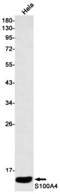 Western Blot: S100A4 Antibody (S01-7H1) [NBP3-19607]