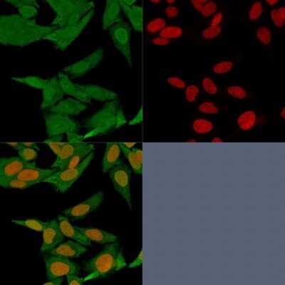 Immunocytochemistry/ Immunofluorescence: S100A4 Antibody (S100A4/1481) - Azide and BSA Free [NBP2-54580]