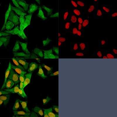 Immunocytochemistry/ Immunofluorescence: S100A4 Antibody (S100A4/1482) [NBP2-53270]