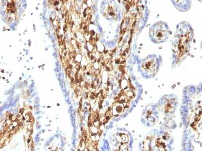 Immunohistochemistry-Paraffin: S100A4 Antibody (S100A4/1482) [NBP2-53270]