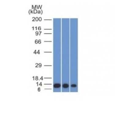 Western Blot: S100A4 Antibody (S100A4/1482) [NBP2-53270]