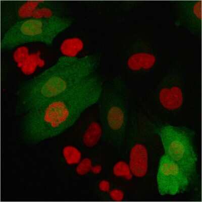 Immunocytochemistry/ Immunofluorescence: S100A4 Antibody (S100A4/2750R) - Azide and BSA Free [NBP3-08460]