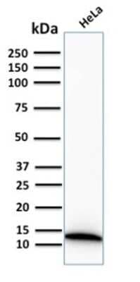 Western Blot: S100A4 Antibody (S100A4/2750R) [NBP3-07587]