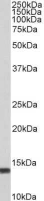 Western Blot: S100A4 Antibody [NB100-55404]
