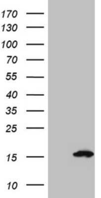 Western Blot: S100A5 Antibody (OTI4C9) [NBP2-45660]