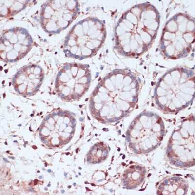 Immunohistochemistry-Paraffin: S100A5 Antibody - Azide and BSA Free [NBP2-93842]