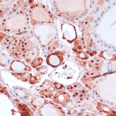 Immunohistochemistry-Paraffin: S100A5 Antibody - Azide and BSA Free [NBP2-93842]