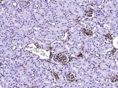 Immunohistochemistry-Paraffin: S100A6 Antibody (016) [NBP2-90488]