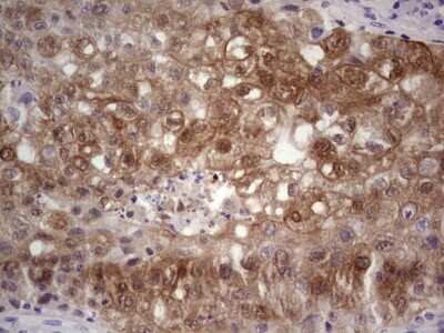 Immunohistochemistry: S100A6 Antibody (OTI5A10) [NBP2-45661]