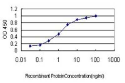 ELISA: S100A6 Antibody (6B5) [H00006277-M10]