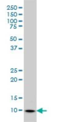 Western Blot: S100A6 Antibody (6B5) [H00006277-M10]