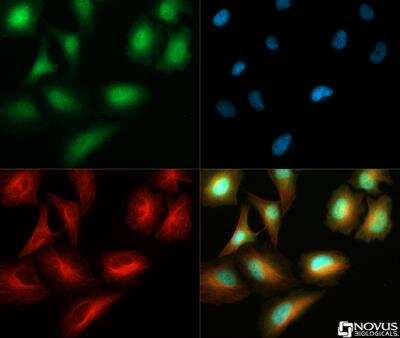 Immunocytochemistry/ Immunofluorescence: S100A6 Antibody [NB110-93274]