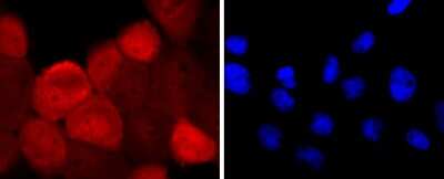 Immunocytochemistry/ Immunofluorescence: S100A6 Antibody (JF0976) [NBP2-67123]