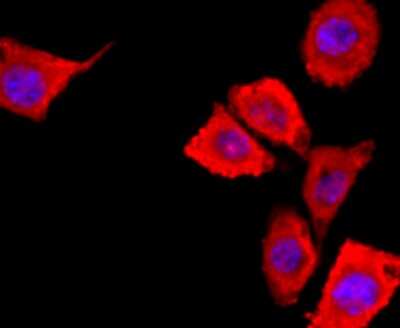 Immunocytochemistry/ Immunofluorescence: S100A6 Antibody (JF0976) [NBP2-67123]