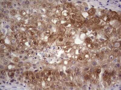 Immunohistochemistry: S100A6 Antibody (OTI5A10) - Azide and BSA Free [NBP2-73969]