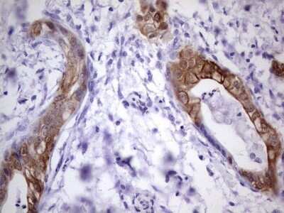Immunohistochemistry: S100A6 Antibody (OTI5A10) - Azide and BSA Free [NBP2-73969]