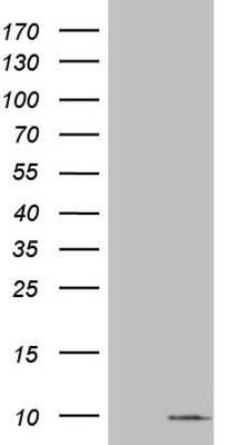 Western Blot: S100A6 Antibody (OTI5A10)Azide and BSA Free [NBP2-73969]