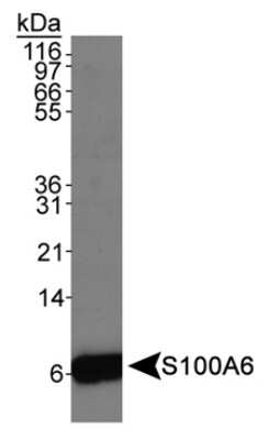 Western Blot: S100A6 Antibody [NB110-93274]