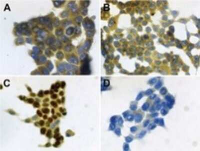Immunohistochemistry: S100A7/Psoriasin Antibody (47C1068) - Azide Free [NBP2-24911]
