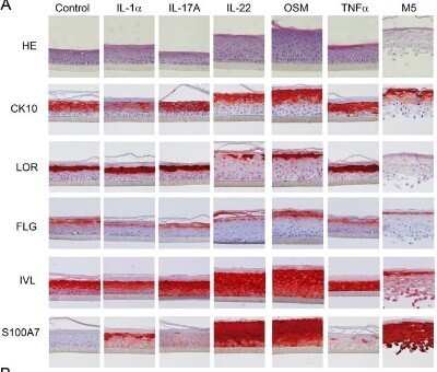 Immunohistochemistry: S100A7/Psoriasin Antibody (47C1068) - Azide Free [NBP2-24911]