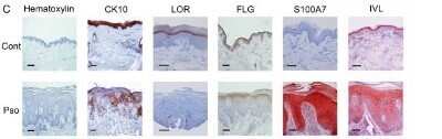 Immunohistochemistry: S100A7/Psoriasin Antibody (47C1068) - Azide Free [NBP2-24911]