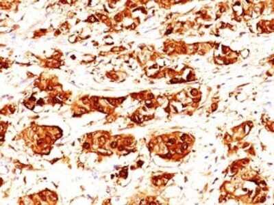 Immunohistochemistry-Paraffin: S100A7/Psoriasin Antibody (47C1068) - Azide Free [NBP2-24911]