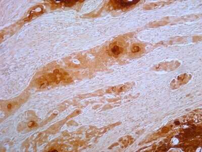 Immunohistochemistry-Paraffin: S100A7/Psoriasin Antibody (47C1068) - Azide Free [NBP2-24911]
