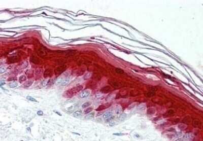 Immunohistochemistry-Paraffin: S100A7/Psoriasin Antibody (47C1068) - Azide Free [NBP2-24911]