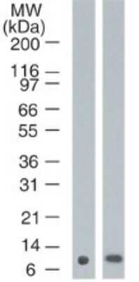 Western Blot: S100A7/Psoriasin Antibody (47C1068)Azide Free [NBP2-24911]